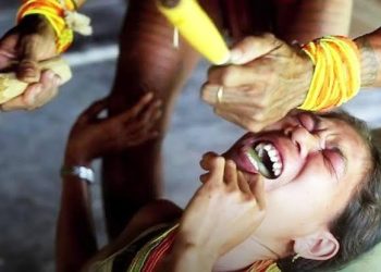 Bikin Ngilu, Ini Tradisi Kerik Gigi Asal Suku Mentawai