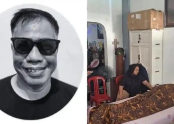 Serangan Jantung Jadi Penyebab Temon Meninggal, Ini Riwayat Hipertensi yang Dideritanya