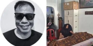 Serangan Jantung Jadi Penyebab Temon Meninggal, Ini Riwayat Hipertensi yang Dideritanya