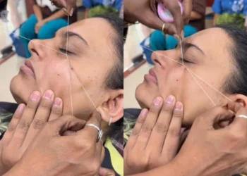Bikin Netizen Ngilu, Tren Cara Hilangkan Kutil Diikat Benang Ternyata Berbahaya!