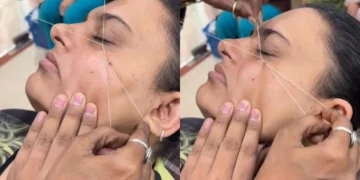Bikin Netizen Ngilu, Tren Cara Hilangkan Kutil Diikat Benang Ternyata Berbahaya!